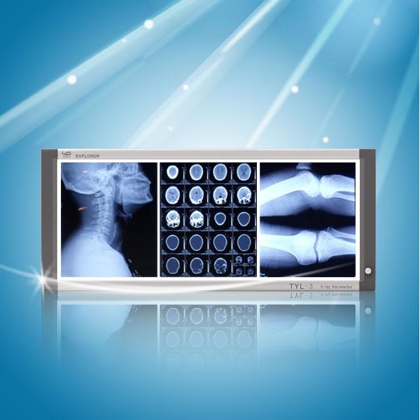 傳統(tǒng)觀片燈與LED觀片燈有什么區(qū)別？